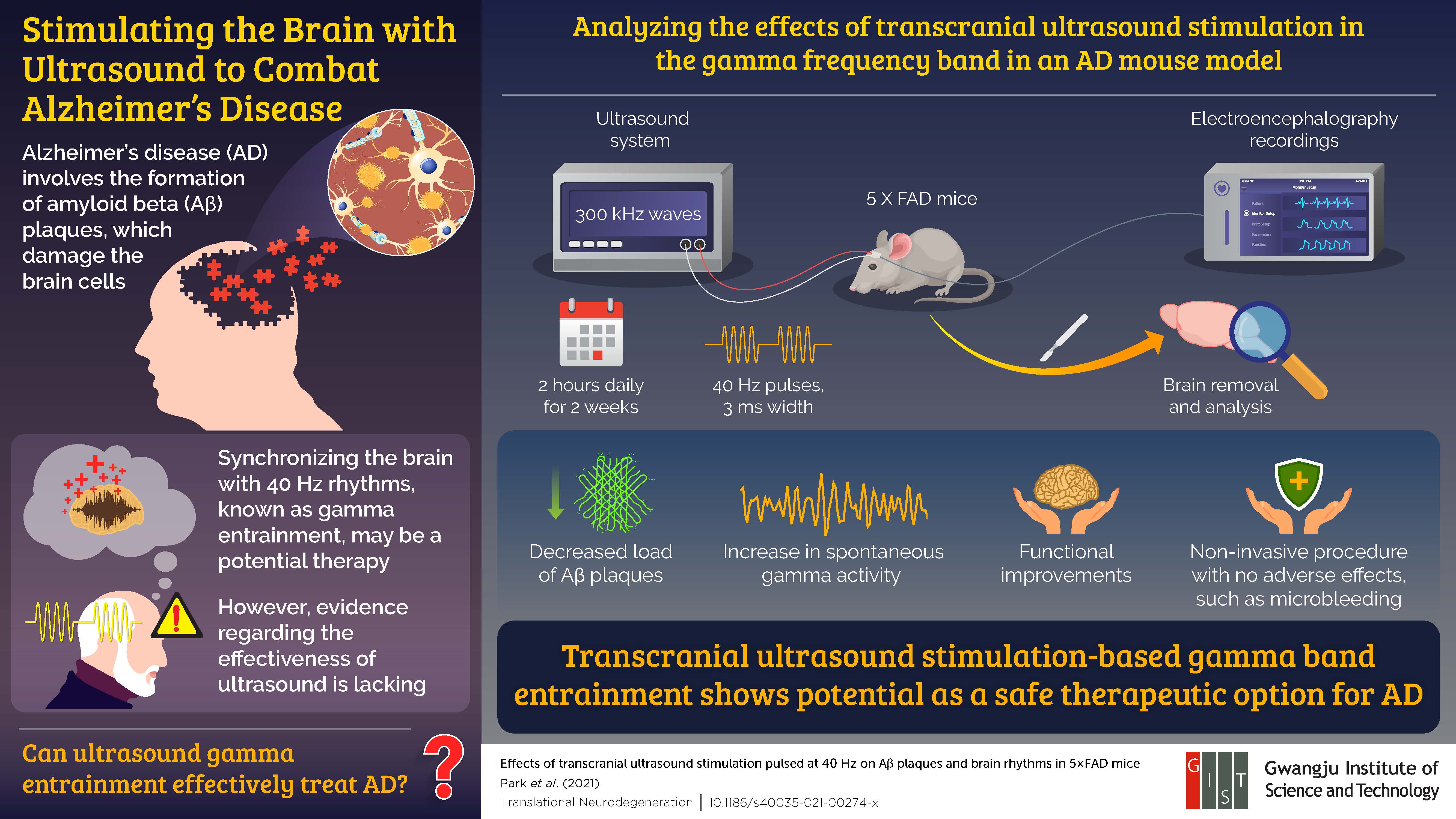 Researchers from the Gwangju Institute of Science and Technology Propose Ultrasound Stimulation as an Effective Therapy for Alzheimer’s Disease in New Study 이미지