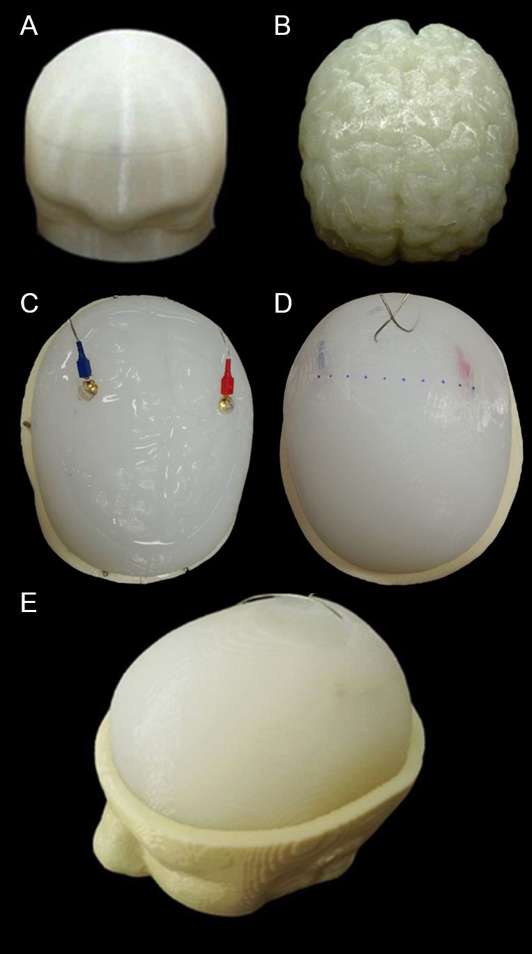 [보도자료] 전성찬+정의헌 교수팀, 뇌 자극 치료 정확성 검증하는 뇌 팬텀 개발 이미지