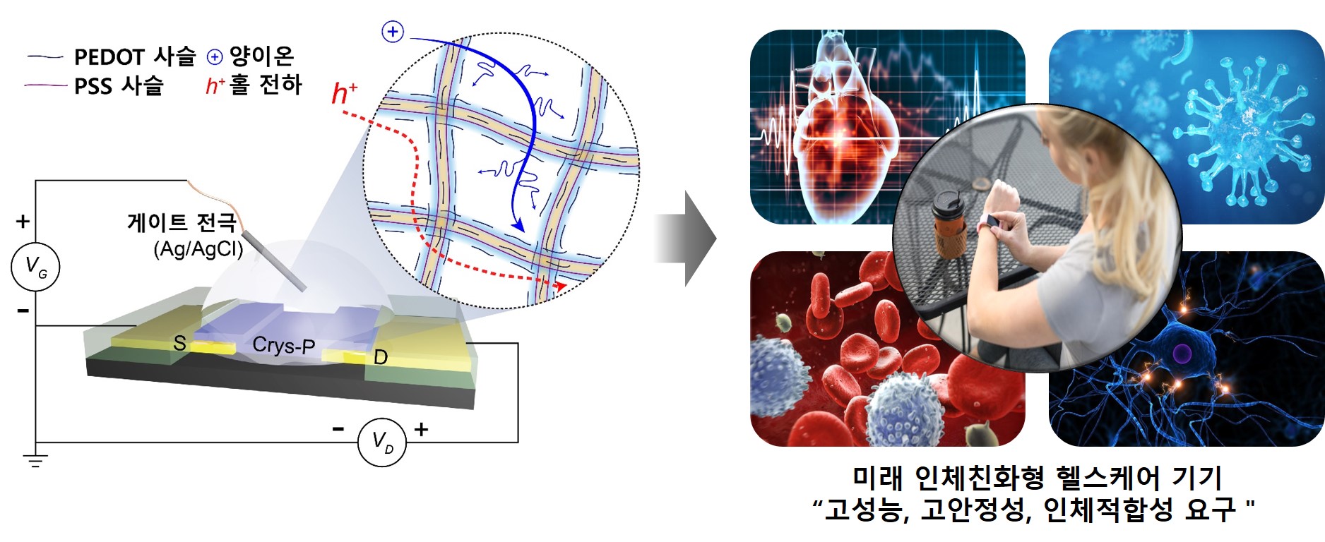 윤명한·이광희 교수 연구팀, 인체 이식형 전자소자 개발(한국연구재단) 이미지